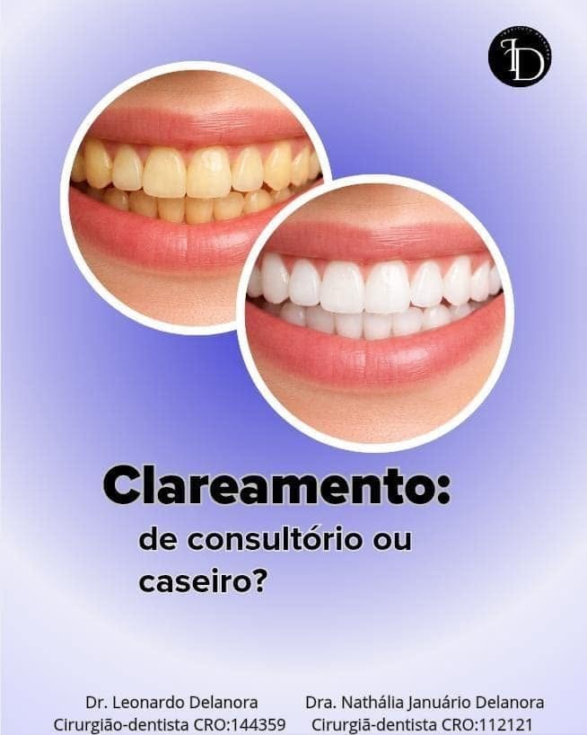 Clareamento dental