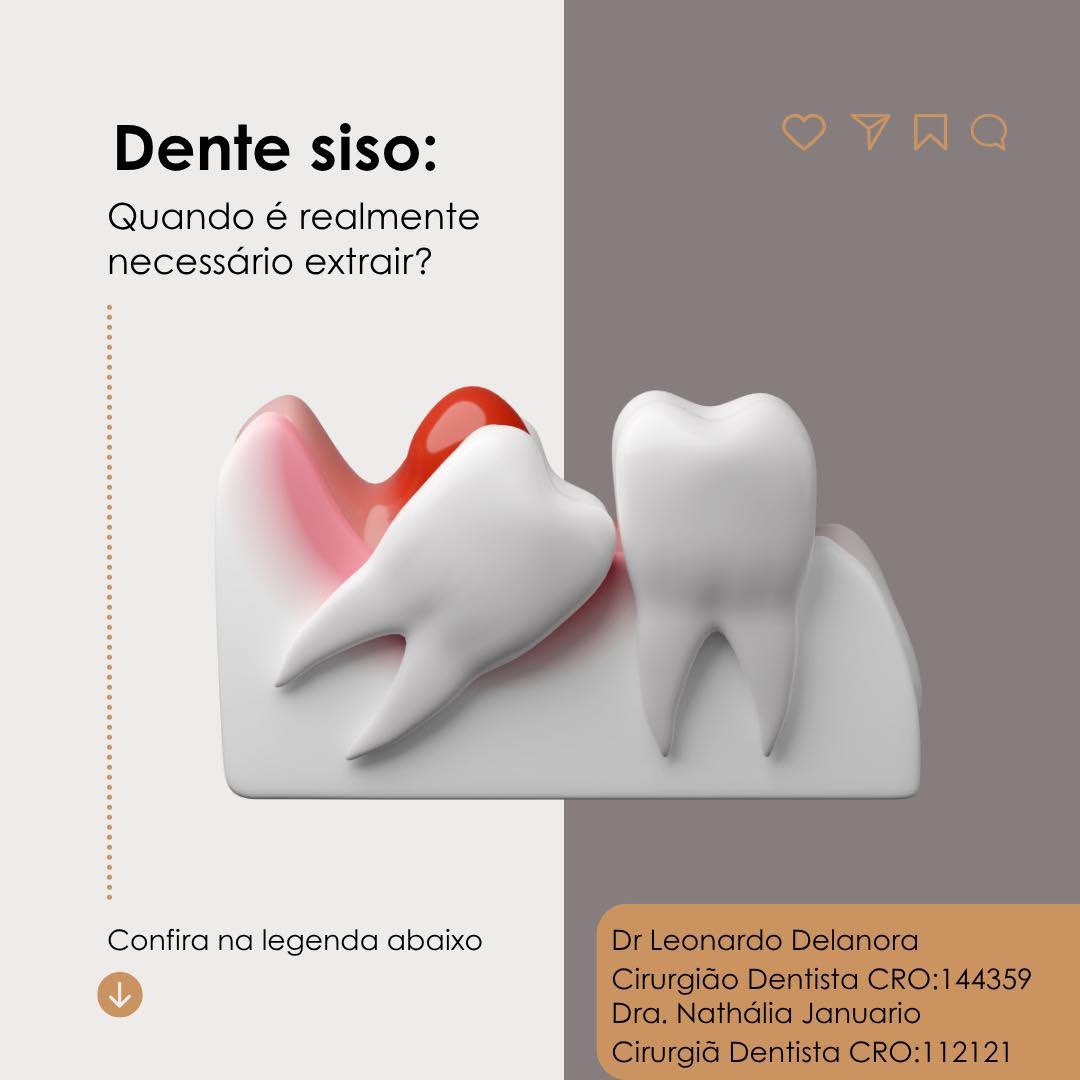 Extração de siso