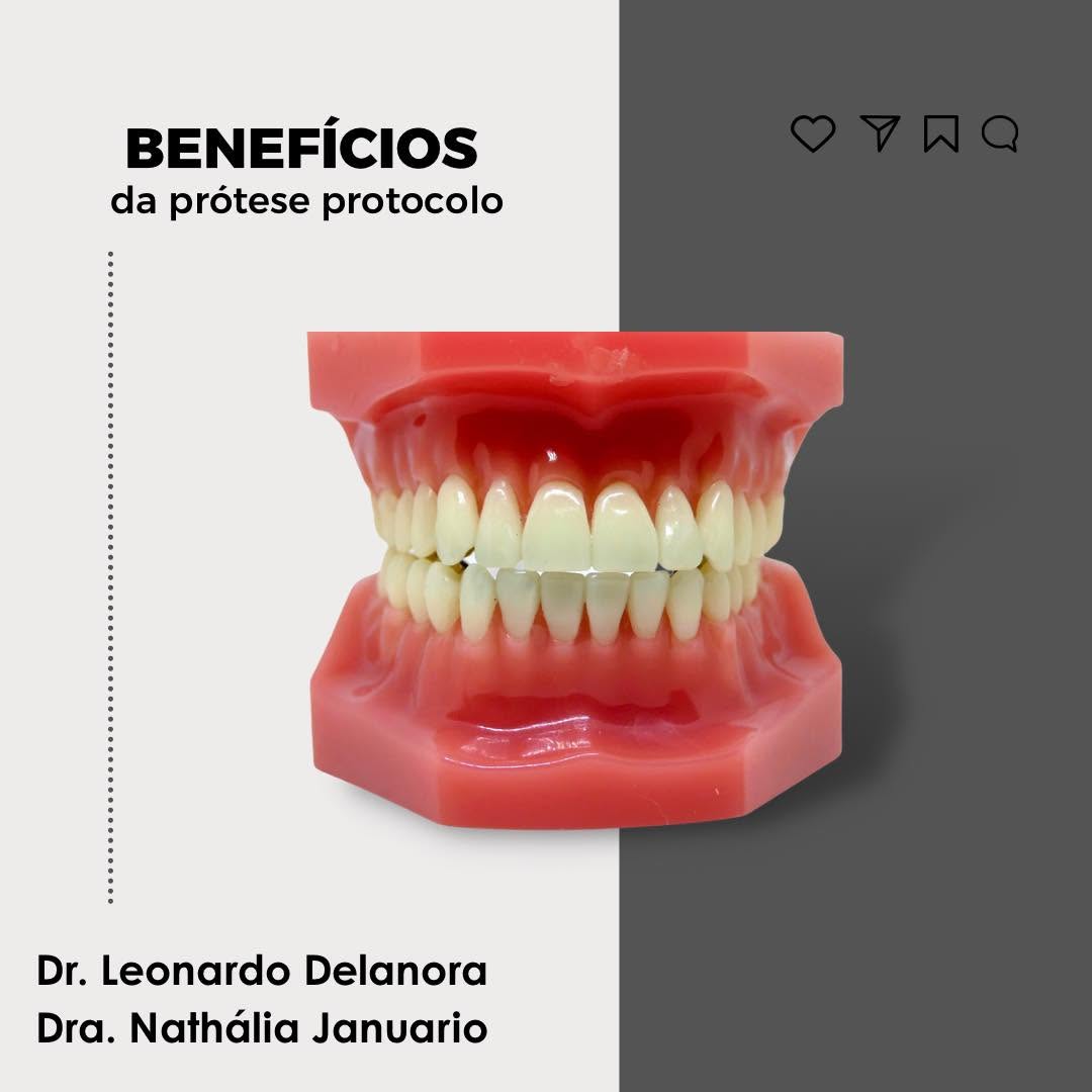 Implante dentário